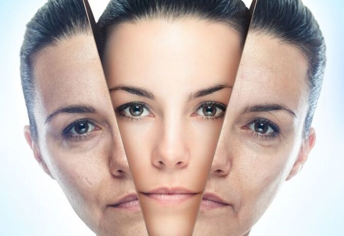 عملية تخليص بشرة الوجه من التغيرات المرتبطة بالعمر